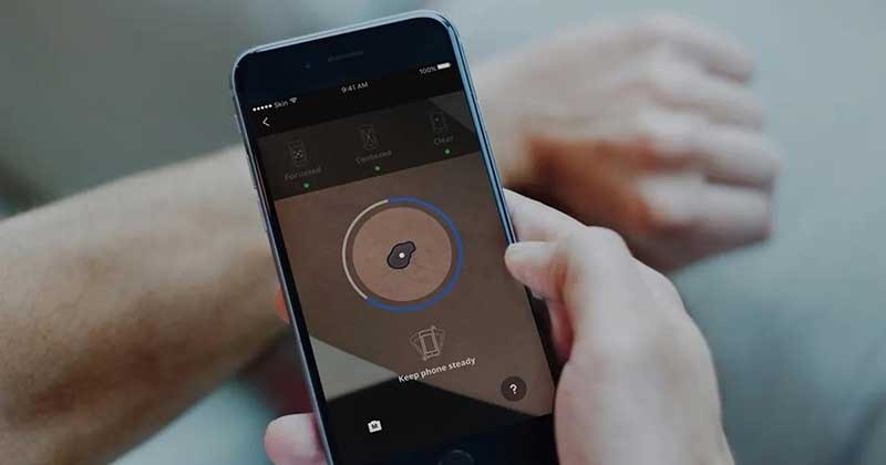 ত্বকের ক্যান্সার শনাক্তে সহায়তা করবে মোবাইল অ্যাপ 
