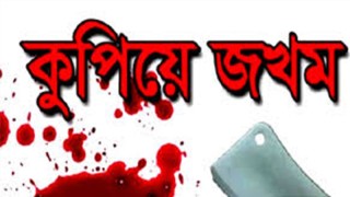দাউদকান্দিতে পূর্ব শত্রুতার জের ধরে যুবককে কুপিয়ে জখম