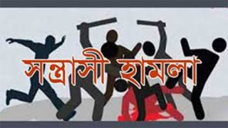 সংবাদ প্রকাশের জেরে ব্রাহ্মণবাড়িয়ায় সাংবাদিকের ওপর সন্ত্রাসী হামলা